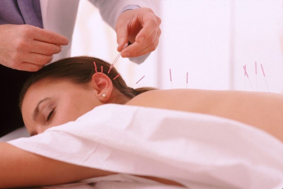 Acupuncture and acupuncture with cervical osteochondosis
